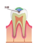 実質欠損