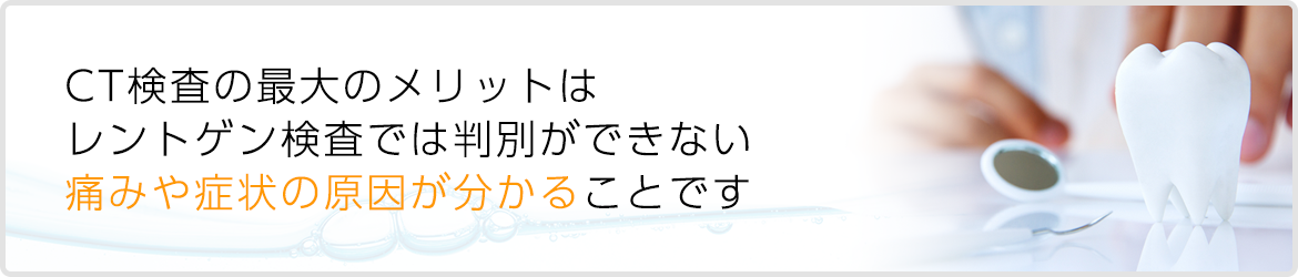 CT検査のメリット